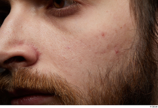HD Face Skin Andrew Elliott cheek face hair nose skin…